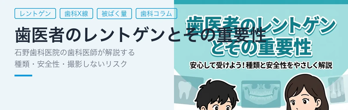 歯医者のレントゲンとその重要性 - 石野歯科医院マンガで解説ガイド